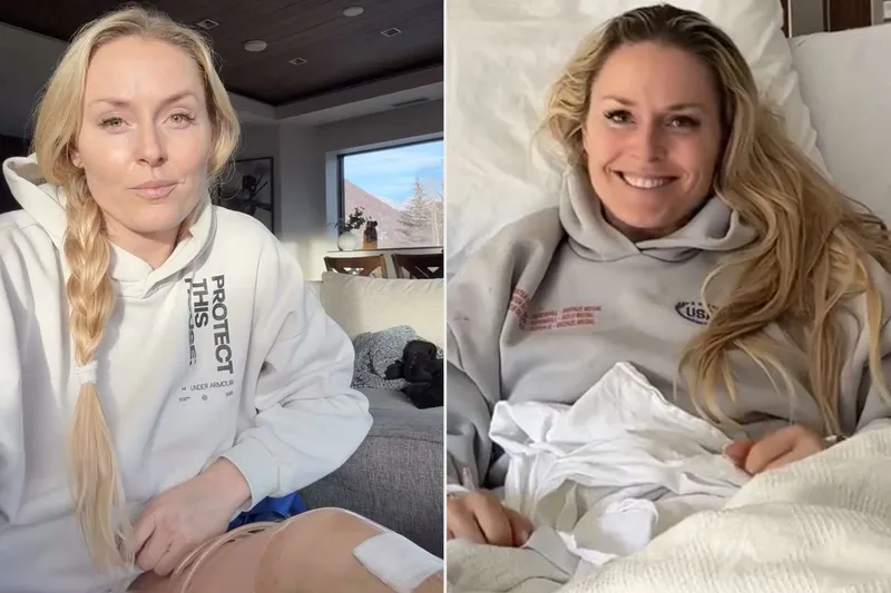 Lindsey Vonn's Leg-Saving Miracle: How an ACL Tear Prevented Amputation After 2026 Olympics Nightmare