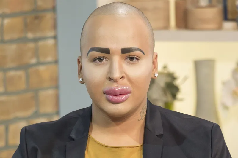 The Lip King's Final Fatal Fix: How 'Botched' Star's Surgery Addiction Defied Doctors' Warnings